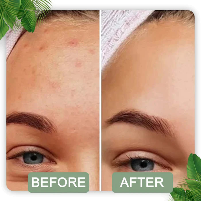 Grüner Matcha Maskenstick - Tiefenreinigung & antioxidative Hautpflege
