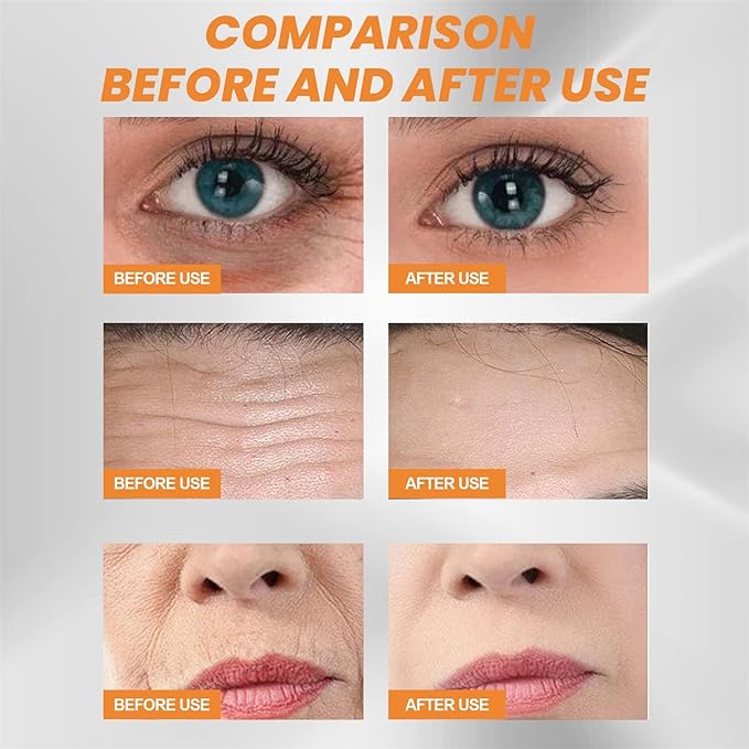 Collagen Augenpads - Wasserlösliche Kollagenfolie - Anti-Aging & Feuchtigkeitsspendende Pflege für glatte Haut