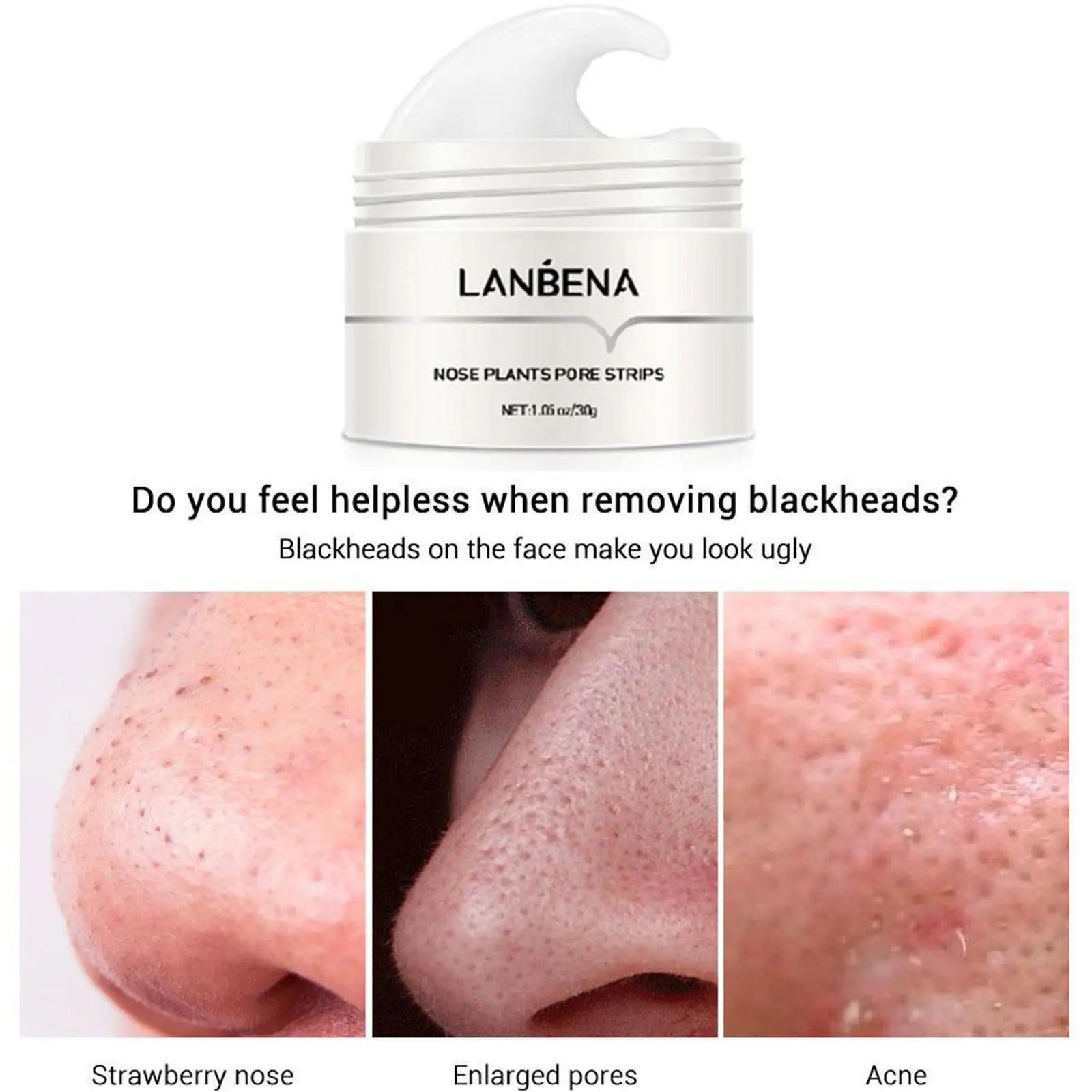 ClearSkin Pro Mitesser Entferner Maske - Tiefenreinigende Nasenstrips, Porenverkleinerung, Feuchtigkeitsspendend, für alle Hauttypen