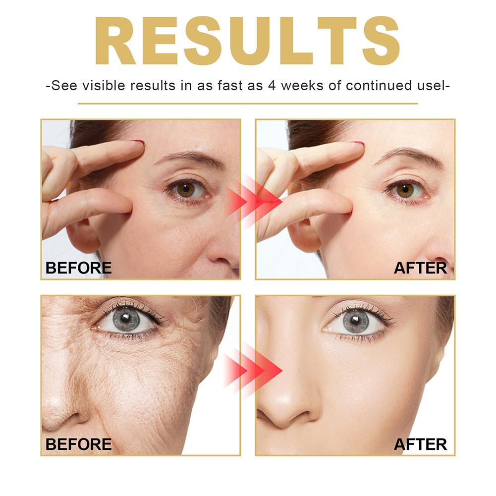 GoldenRevive Anti-Aging-Serum - Fortschrittliche Formel für Glatte, Strahlende Haut und Intensiven Kollagen-Boost